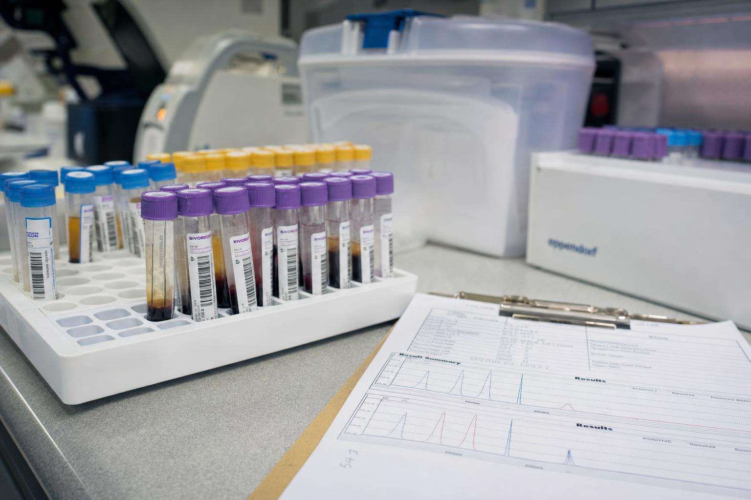 Laboratory sample rack with urine tubes and printed NHANES-style chart, no people