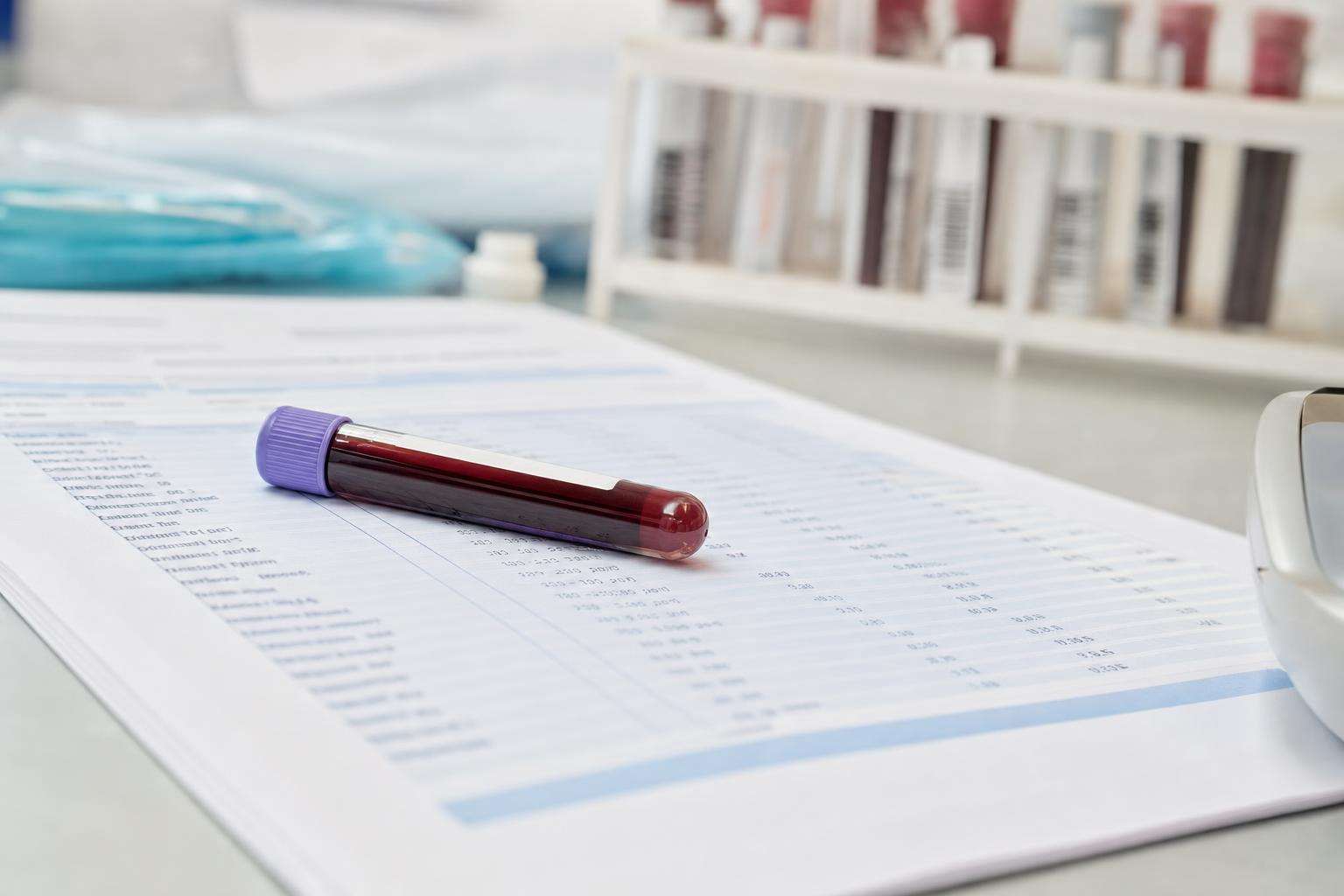 Iron panel laboratory report style papers beside a plain blood tube, no people