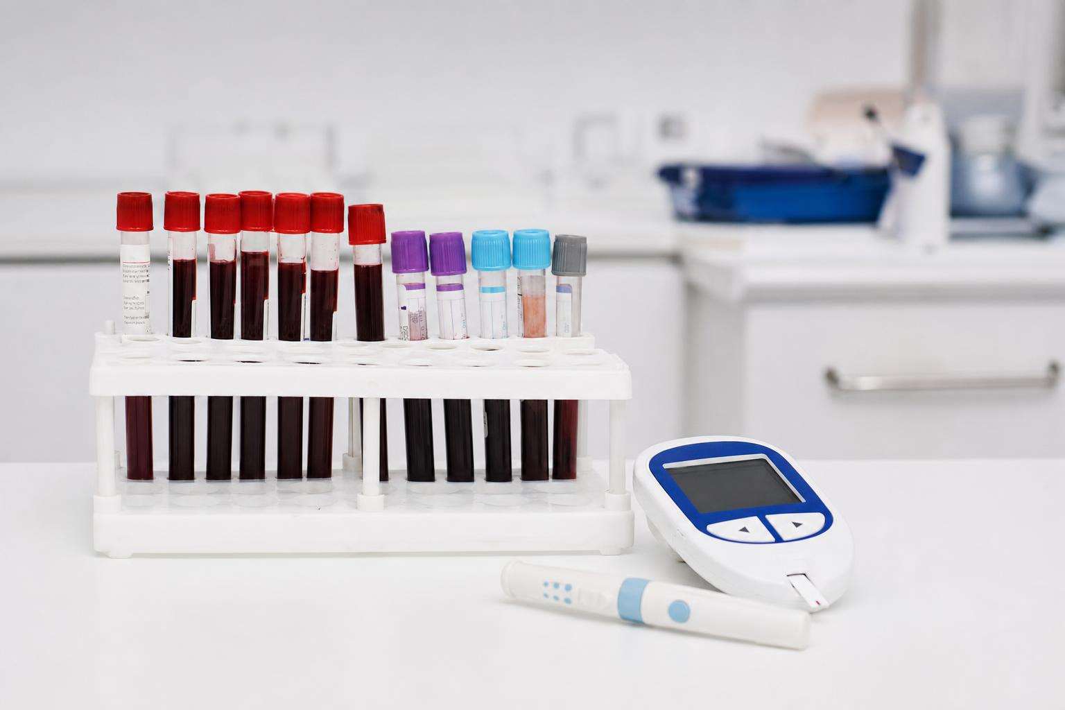 Fasting blood draw tubes and glucose meter on a clean clinical counter, no people