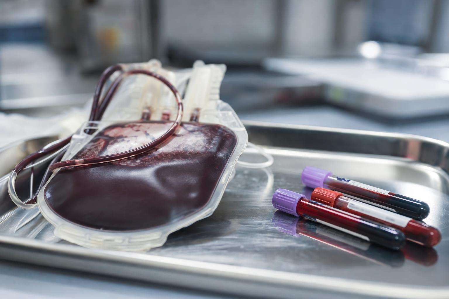 Blood collection bag and laboratory tubes on a clinical tray representing therapeutic phlebotomy, no people