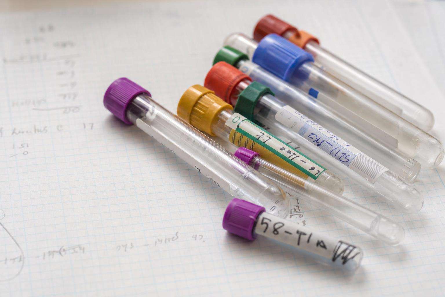 Antibody test schematic printout beside PCR tube concept, no people