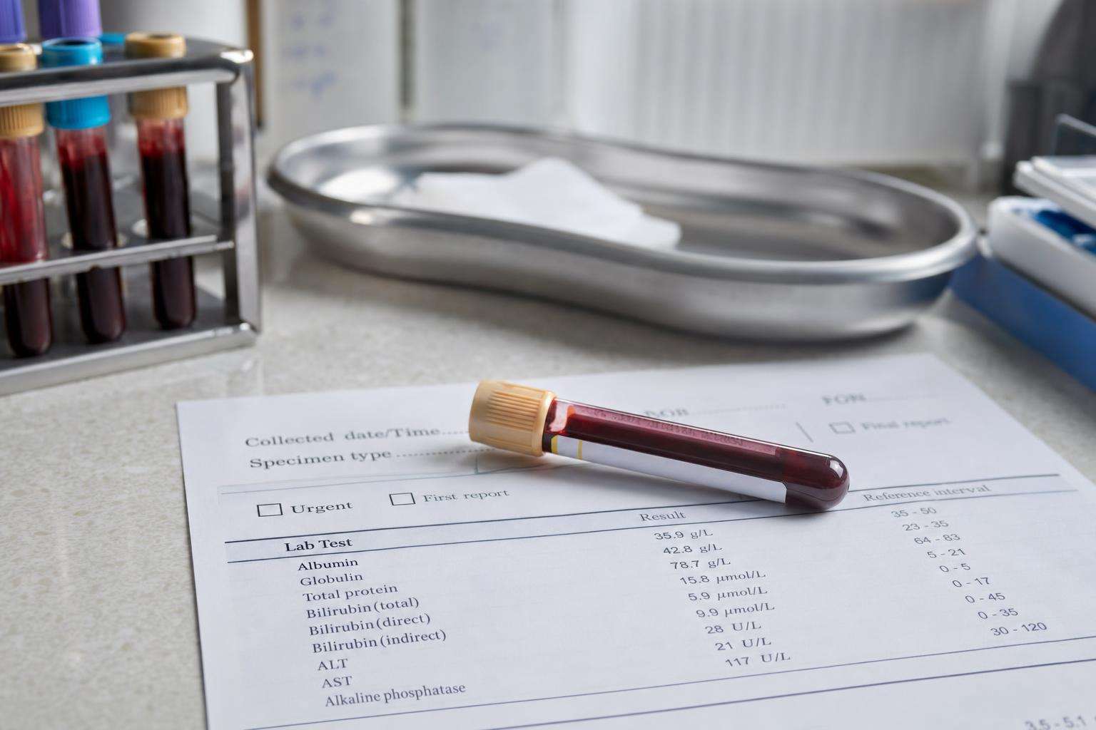 Laboratory blood collection tube beside a printed serum PFAS panel report on a clean white surface