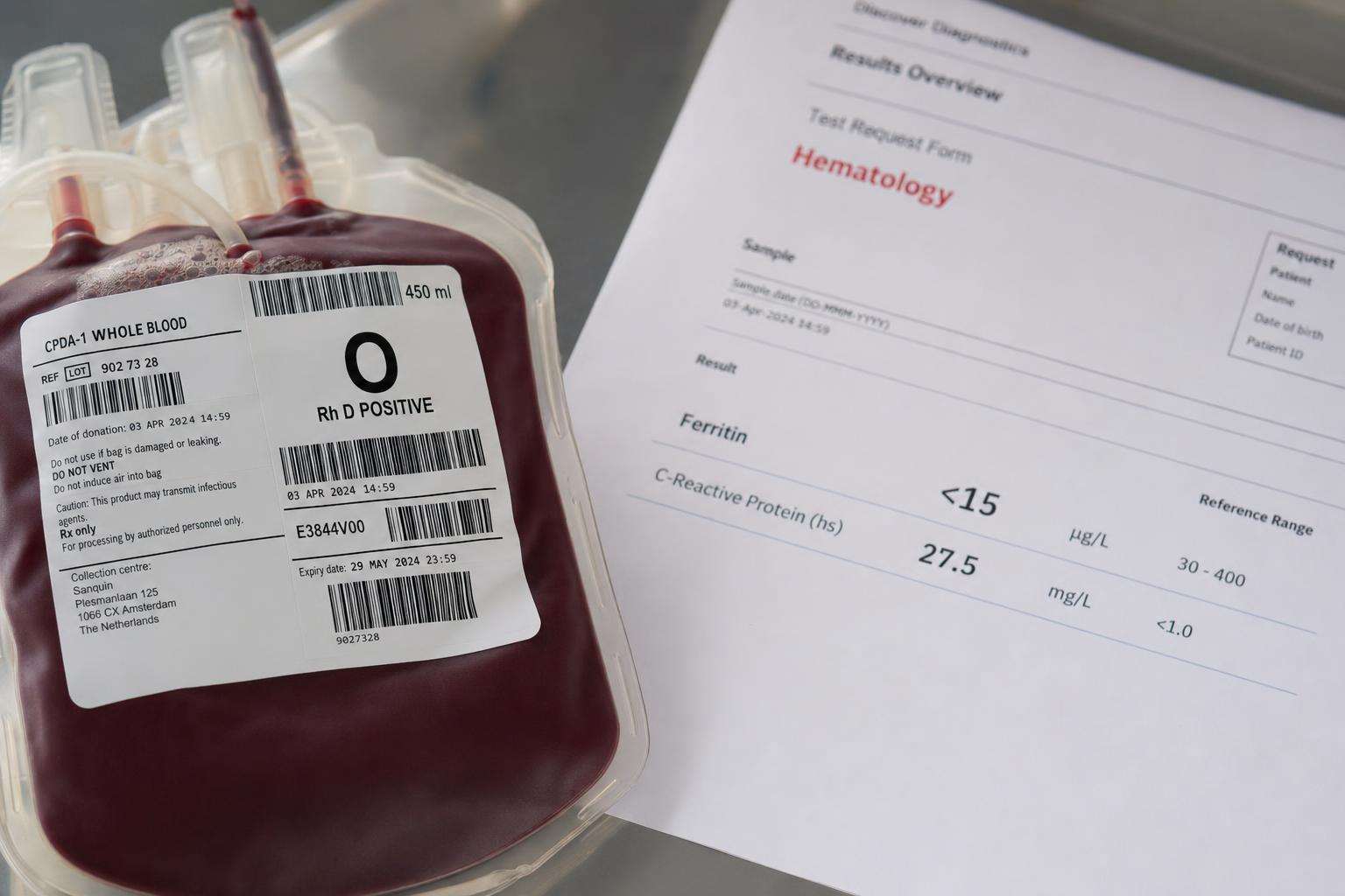 Transfusion bag and iron lab slip on clinical table, no people